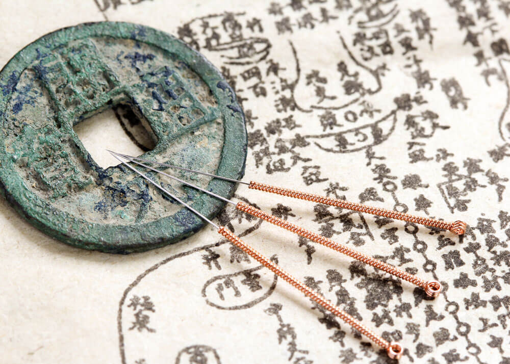 Close-up of acupuncture needles laying on top of a chinese medicine illustration showing acupuncture points.